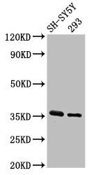 GAS1 Antibody - Positive Western Blot detected in SH-SY5Y whole cell lysate, 293 whole cell lysate. All lanes: GAS1 antibody at 3.2 µg/ml Secondary Goat polyclonal to rabbit IgG at 1/50000 dilution. Predicted band size: 36 KDa. Observed band size: 36 KDa