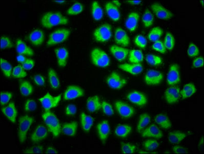 GAS1 Antibody - Immunofluorescence staining of Hela cells with GAS1 Antibody at 1:133, counter-stained with DAPI. The cells were fixed in 4% formaldehyde, permeabilized using 0.2% Triton X-100 and blocked in 10% normal Goat Serum. The cells were then incubated with the antibody overnight at 4°C. The secondary antibody was Alexa Fluor 488-congugated AffiniPure Goat Anti-Rabbit IgG(H+L).