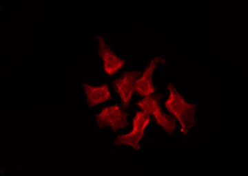 GAS1 Antibody - Staining MCF-7 cells by IF/ICC. The samples were fixed with PFA and permeabilized in 0.1% Triton X-100, then blocked in 10% serum for 45 min at 25°C. The primary antibody was diluted at 1:200 and incubated with the sample for 1 hour at 37°C. An Alexa Fluor 594 conjugated goat anti-rabbit IgG (H+L) Ab, diluted at 1/600, was used as the secondary antibody.