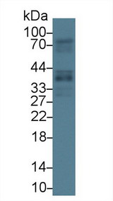 GAS2 Antibody - Western Blot; Sample: Human Lung lysate; Primary Ab: 1µg/ml Rabbit Anti-Human GAS2 Antibody Second Ab: 0.2µg/mL HRP-Linked Caprine Anti-Rabbit IgG Polyclonal Antibody