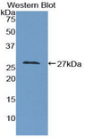 GAS2 Antibody - Western blot of recombinant GAS2.  This image was taken for the unconjugated form of this product. Other forms have not been tested.