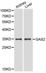 GAS2 Antibody - Western blot of ARHGEF7 pAb in extracts from mouse kidney and liver tissues.