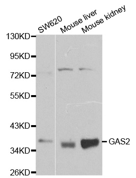 GAS2 Antibody - Western blot analysis of extracts of various cell lines, using GAS2 antibody at 1:1000 dilution. The secondary antibody used was an HRP Goat Anti-Rabbit IgG (H+L) at 1:10000 dilution. Lysates were loaded 25ug per lane and 3% nonfat dry milk in TBST was used for blocking.