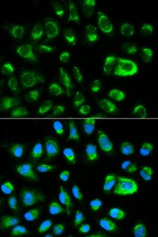 GAS2 Antibody - Immunofluorescence analysis of HeLa cells using GAS2 antibody. Blue: DAPI for nuclear staining.