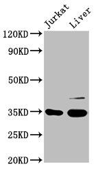 GAS2 Antibody - Western Blot Positive WB detected in: Jurkat whole cell lysate, Rat liver tissue All lanes: GAS2 antibody at 3.3µg/ml Secondary Goat polyclonal to rabbit IgG at 1/50000 dilution Predicted band size: 35, 16 kDa Observed band size: 35 kDa