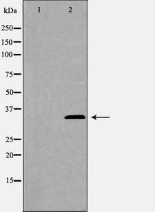 GAS2 Antibody - Western blot analysis of mouse liver tissue lysates using GAS2 antibody. The lane on the left is treated with the antigen-specific peptide.