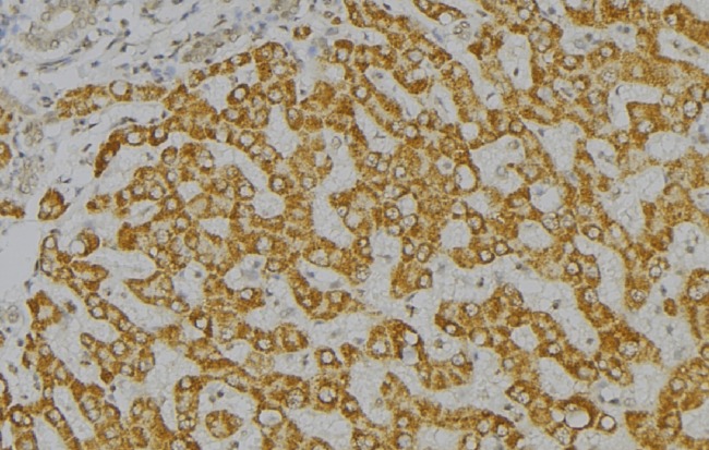 GAS2 Antibody - 1:100 staining mouse liver tissue by IHC-P. The sample was formaldehyde fixed and a heat mediated antigen retrieval step in citrate buffer was performed. The sample was then blocked and incubated with the antibody for 1.5 hours at 22°C. An HRP conjugated goat anti-rabbit antibody was used as the secondary.