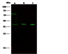 GAS2 Antibody - Anti-GAS2 rabbit polyclonal antibody at 1:500 dilution. Lane A: HepG2 whole cell lysate. Lane B: HeLa whole cell lysate. Lane C: Jurkat whole cell lysate. Lysates/proteins at 30 ug per lane. Secondary: Goat Anti-Rabbit IgG H&L (Dylight 800) at 1/10000 dilution. Developed using the Odyssey technique. Performed under reducing conditions. Predicted band size: 35 kDa. Observed band size: 35 kDa. (We are unsure as to the identity of these extra bands.)