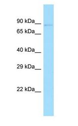 GAS2L1 Antibody - GAS2L1 antibody Western Blot of Fetal Spleen.  This image was taken for the unconjugated form of this product. Other forms have not been tested.