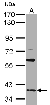 GAS2L1 Antibody - Sample (30 ug of whole cell lysate). A: A431. 7.5% SDS PAGE. GAS2L1 antibody diluted at 1:500
