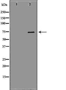 GAS2L1 Antibody - Western blot analysis of extracts of K562 cells using GAS2L1 antibody. The lane on the left is treated with the antigen-specific peptide.
