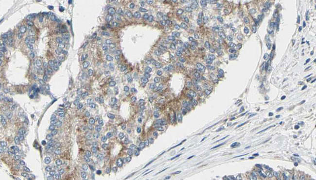 GAS2L1 Antibody - 1:100 staining human prostate tissue by IHC-P. The sample was formaldehyde fixed and a heat mediated antigen retrieval step in citrate buffer was performed. The sample was then blocked and incubated with the antibody for 1.5 hours at 22°C. An HRP conjugated goat anti-rabbit antibody was used as the secondary.