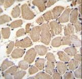 GAS2L2 Antibody - GAS2L2 Antibody immunohistochemistry of formalin-fixed and paraffin-embedded human skeletal muscle followed by peroxidase-conjugated secondary antibody and DAB staining.