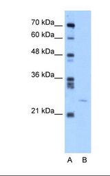 GAS41 Antibody - Lane A: Marker. Lane B: Jurkat cell lysate. Antibody concentration: 5.0 ug/ml. Gel concentration: 12%.  This image was taken for the unconjugated form of this product. Other forms have not been tested.