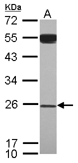 GAS41 Antibody - Sample (30 ug of whole cell lysate) A: A549 12% SDS PAGE YEATS4 antibody diluted at 1:1000