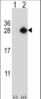 GAS41 Antibody - Western blot of YEATS4 (arrow) using rabbit polyclonal YEATS4 Antibody. 293 cell lysates (2 ug/lane) either nontransfected (Lane 1) or transiently transfected (Lane 2) with the YEATS4 gene.