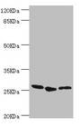 GAS41 Antibody - Western blot All Lanes:YEATS4 antibody at 1.44ug/ml Lane 1:A549 whole cell lysate Lane 2:rat gonad tissue Lane 3:U251 whole cell lysate Secondary Goat polyclonal to rabbit at 1/10000 dilution Predicted band size: 26kDa Observed band size: 26kDa