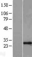 GAS41 Protein - Western validation with an anti-DDK antibody * L: Control HEK293 lysate R: Over-expression lysate