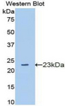 GAS6 Antibody - Western blot of recombinant GAS6.  This image was taken for the unconjugated form of this product. Other forms have not been tested.