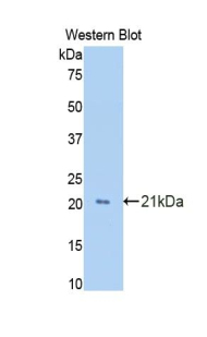 GAS6 Antibody - Western blot of GAS6 antibody.