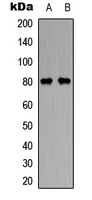 GAS6 Antibody - Western blot analysis of GAS6 expression in SW480 (A); COLO205 (B) whole cell lysates.