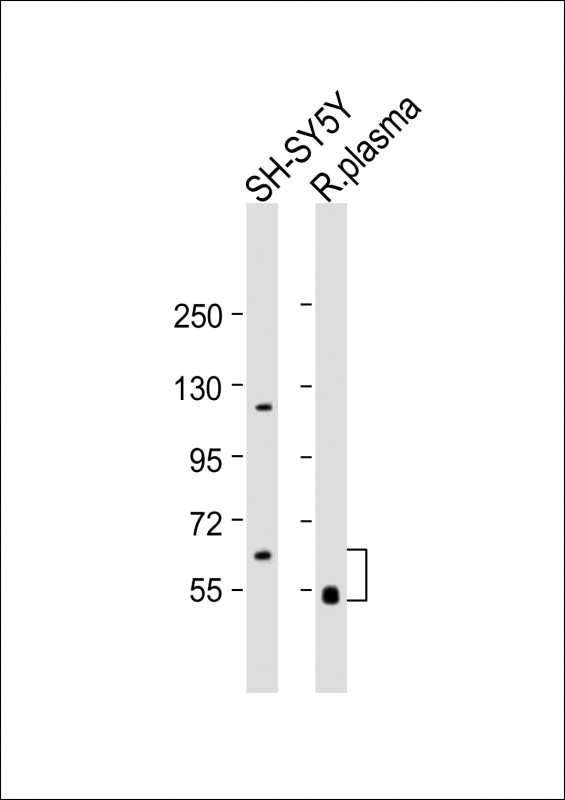 GAS6 Antibody - All lanes: Anti-GAS6 Antibody (Center) at 1:2000 dilution Lane 1: rat plasma lysate Lane 2: SH-SY5Y whole cell lysate Lysates/proteins at 20 µg per lane. Secondary Goat Anti-Rabbit IgG, (H+L), Peroxidase conjugated at 1/10000 dilution. Predicted band size: 80 kDa Blocking/Dilution buffer: 5% NFDM/TBST.