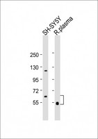 GAS6 Antibody - All lanes: Anti-GAS6 Antibody (Center) at 1:2000 dilution Lane 1: rat plasma lysate Lane 2: SH-SY5Y whole cell lysate Lysates/proteins at 20 µg per lane. Secondary Goat Anti-Rabbit IgG, (H+L), Peroxidase conjugated at 1/10000 dilution. Predicted band size: 80 kDa Blocking/Dilution buffer: 5% NFDM/TBST.