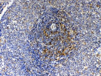 GAS6 Antibody - IHC testing of FFPE rat spleen tissue with GAS6 antibody at 1ug/ml. Required HIER: steam section in pH6 citrate buffer for 20 min and allow to cool prior to testing.
