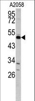 GAS7 Antibody - Western blot of GAS7 antibody in A2058 cell line lysates (35 ug/lane). GAS7 (arrow) was detected using the purified antibody.