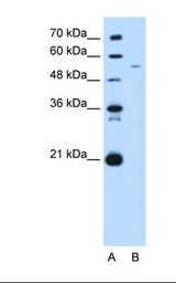 GAS7 Antibody - Lane A: Marker. Lane B: HepG2 cell lysate. Antibody concentration: 5.0 ug/ml. Gel concentration: 12%.  This image was taken for the unconjugated form of this product. Other forms have not been tested.