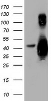 GAS7 Antibody - HEK293T cells were transfected with the pCMV6-ENTRY control (Left lane) or pCMV6-ENTRY GAS7 (Right lane) cDNA for 48 hrs and lysed. Equivalent amounts of cell lysates (5 ug per lane) were separated by SDS-PAGE and immunoblotted with anti-GAS7.