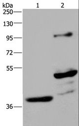 GAS7 Antibody - Western blot analysis of Human fetal brain and mouse brain tissue, using GAS7 Polyclonal Antibody at dilution of 1:625.