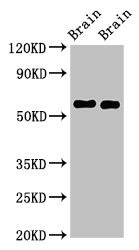 GAS7 Antibody - Western Blot Positive WB detected in:Mouse brain tissue,Rat brain tissue All Lanes:GAS7 antibody at 2.5µg/ml Secondary Goat polyclonal to rabbit IgG at 1/50000 dilution Predicted band size: 55,48,40 KDa Observed band size: 55 KDa