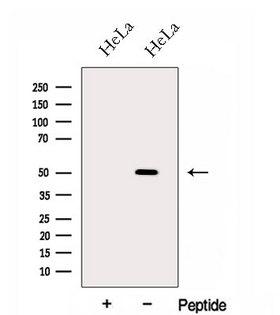 GAS7 Antibody - Western blot analysis of extracts of HeLa cells using GAS7 antibody. The lane on the left was treated with blocking peptide.