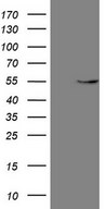 GAS8 Antibody - HEK293T cells were transfected with the pCMV6-ENTRY control. (Left lane) or pCMV6-ENTRY GAS8. (Right lane) cDNA for 48 hrs and lysed. Equivalent amounts of cell lysates. (5 ug per lane) were separated by SDS-PAGE and immunoblotted with anti-GAS8. (1:2000)