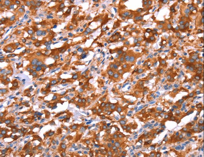 GAS8 Antibody - Immunohistochemistry of paraffin-embedded Human brain using GAS8 Polyclonal Antibody at dilution of 1:40.