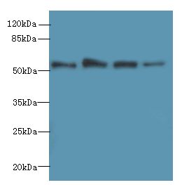 Gasdermin D / GSDMD Antibody - Western blot. All lanes: GSDMD antibody at 4 ug/ml. Lane 1: Jurkat whole cell lysate. Lane 2: HeLa whole cell lysate. Lane 3: A431 whole cell lysate. Lane 4: U251 whole cell lysate. Secondary antibody: Goat polyclonal to Rabbit IgG at 1:10000 dilution. Predicted band size: 53 kDa. Observed band size: 53 kDa.