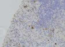 Gasdermin D / GSDMD Antibody - 1:100 staining human lymph node tissue by IHC-P. The sample was formaldehyde fixed and a heat mediated antigen retrieval step in citrate buffer was performed. The sample was then blocked and incubated with the antibody for 1.5 hours at 22°C. An HRP conjugated goat anti-rabbit antibody was used as the secondary.
