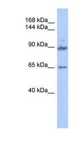 GASP2 / GPRASP2 Antibody - GPRASP2 antibody Western blot of Transfected 293T cell lysate. This image was taken for the unconjugated form of this product. Other forms have not been tested.