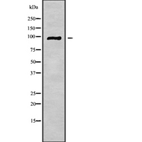 GASP2 / GPRASP2 Antibody - Western blot analysis GASP2 using HeLa whole cells lysates