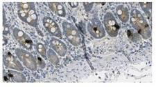 Gastric Inhibitory Peptide Antibody - IHC of paraffin-embedded human duodenum tissue. This image was taken for the unmodified form of this product. Other forms have not been tested.