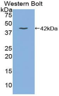 Gastrin Antibody - Western blot of recombinant Gastrin.  This image was taken for the unconjugated form of this product. Other forms have not been tested.