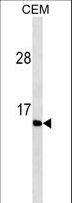 Gastrin Antibody - GAST Antibody western blot of CEM cell line lysates (35 ug/lane). The GAST antibody detected the GAST protein (arrow).