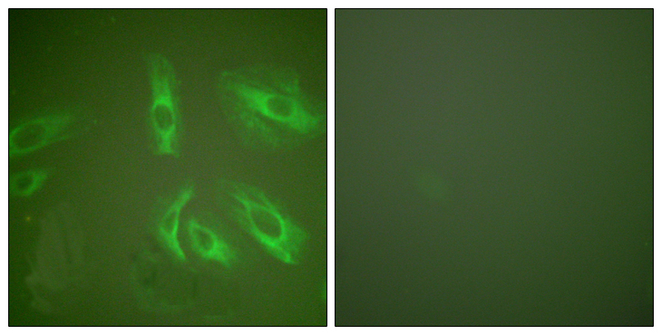 Gastrin Antibody - Immunofluorescence analysis of HeLa cells, using Gastrin Antibody. The picture on the right is blocked with the synthesized peptide.