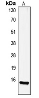 Gastrin Antibody - Western blot analysis of Gastrin expression in HeLa (A) whole cell lysates.