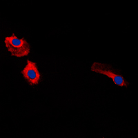 Gastrin Antibody - Immunofluorescent analysis of Gastrin staining in HeLa cells. Formalin-fixed cells were permeabilized with 0.1% Triton X-100 in TBS for 5-10 minutes and blocked with 3% BSA-PBS for 30 minutes at room temperature. Cells were probed with the primary antibody in 3% BSA-PBS and incubated overnight at 4 C in a humidified chamber. Cells were washed with PBST and incubated with a DyLight 594-conjugated secondary antibody (red) in PBS at room temperature in the dark. DAPI was used to stain the cell nuclei (blue).