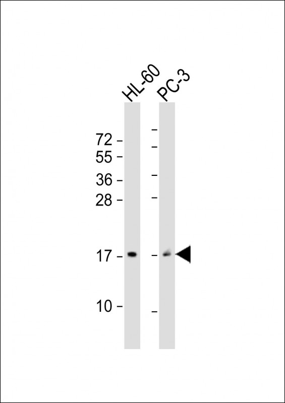 Gastrin Releasing Peptide Antibody - All lanes: Anti-GRP Antibody (Center) at 1:2000 dilution. Lane 1: HL-60 whole cell lysate. Lane 2: PC-3 whole cell lysate Lysates/proteins at 20 ug per lane. Secondary Goat Anti-Rabbit IgG, (H+L), Peroxidase conjugated at 1:10000 dilution. Predicted band size: 16 kDa. Blocking/Dilution buffer: 5% NFDM/TBST.
