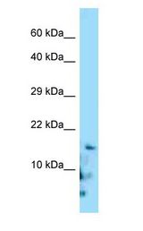 Gastrin Releasing Peptide Antibody - GRP/Gastrin Releasing Peptide antibody Western Blot of HepG2.  This image was taken for the unconjugated form of this product. Other forms have not been tested.