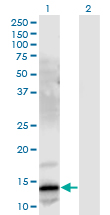 Gastrin Releasing Peptide Antibody - Western Blot analysis of GRP expression in transfected 293T cell line by GRP monoclonal antibody (M03), clone 3A11.Lane 1: GRP transfected lysate(16.39 KDa).Lane 2: Non-transfected lysate.