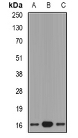 Gastrin Releasing Peptide Antibody - Western blot analysis of GRP expression in mouse lung (A); rat brain (B); rat kidney (C) whole cell lysates.